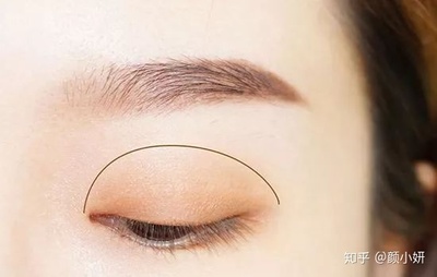 双眼皮就剩睫毛根部肿