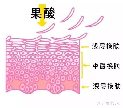 长痘痘要擦水和乳液吗