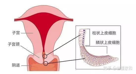 有宫颈糜烂会怀孕吗
