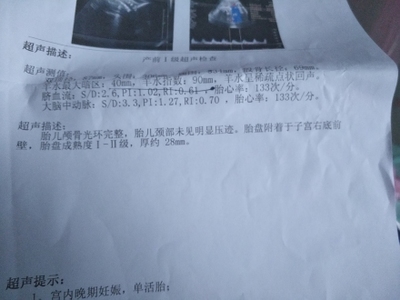 怀孕39周还没入盆正常吗