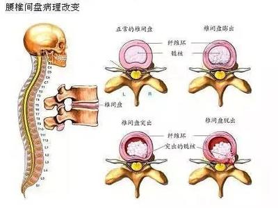 右腰里面疼是怎么回事