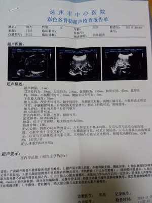 三个月宝宝发烧正常吗