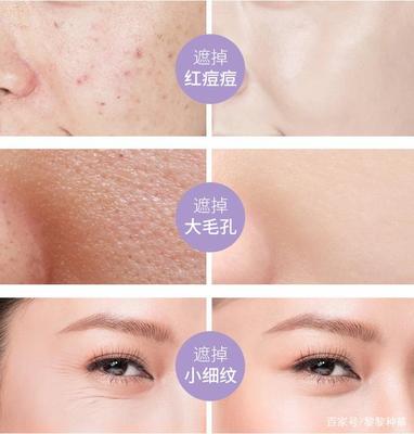 擦隔离会长痘痘吗