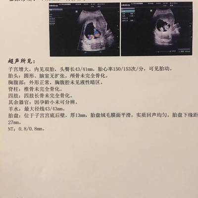怀孕11周宝宝多大图片