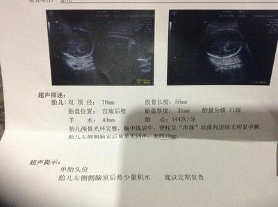 怀孕5个半月是多少周