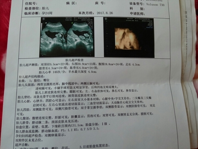 孕妇肾盂分离是什么意思
