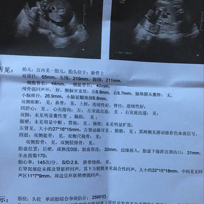 宝宝做核磁共振