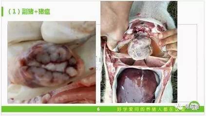 肠道淋巴结肿大是怎么回事