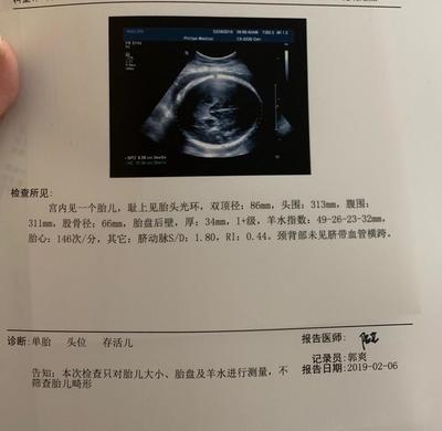 胎儿心跳过快是什么原因