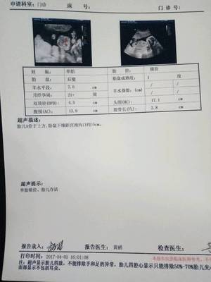 怀孕5个月宝宝有多重