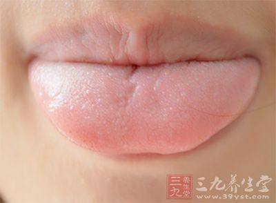 舌头有点肿是怎么回事