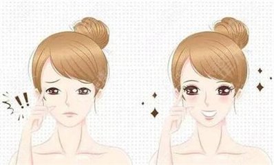 揉眼睛变双眼皮