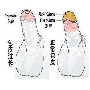 系带炎症怎么治疗