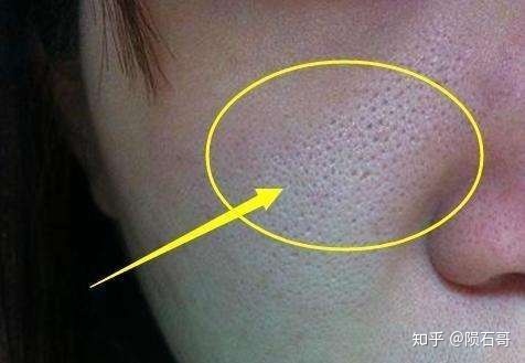 怎么样可以缩小毛孔