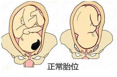 胎儿胎位什么时候固定