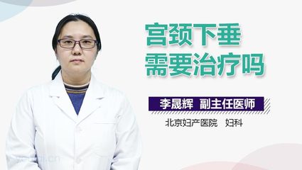 宫颈下垂怎么治疗
