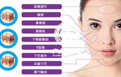 微整 脸部