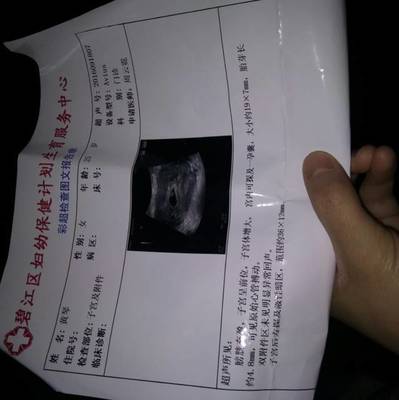 怀孕了怎么看男女