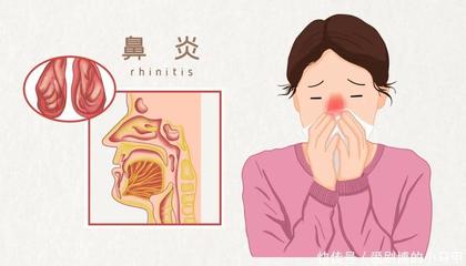 喉咙发炎 咳嗽