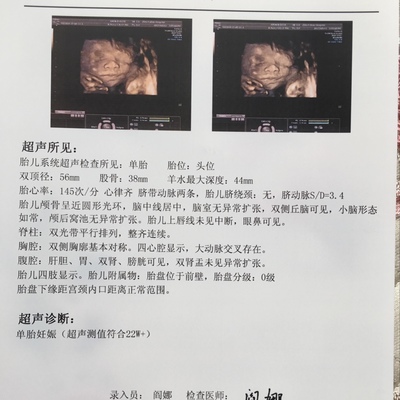 胎儿双顶径标准看男女
