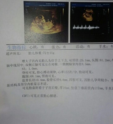 孕妇胎儿心跳多少正常