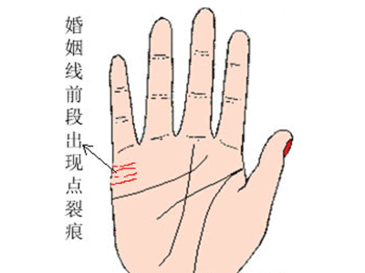 婚姻线4条