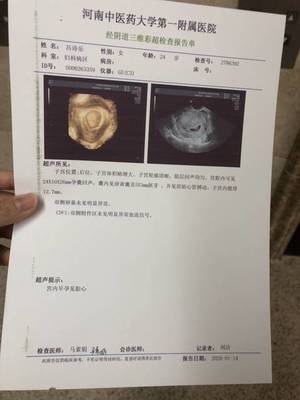 宝宝几周有胎心