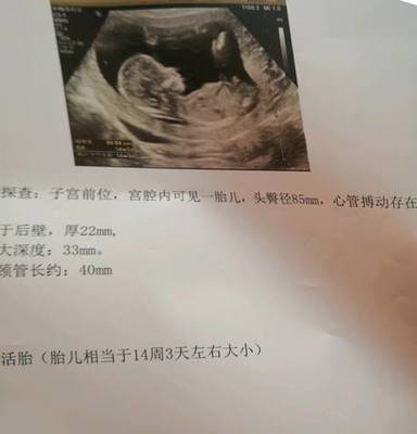 胎儿14周会有胎动吗