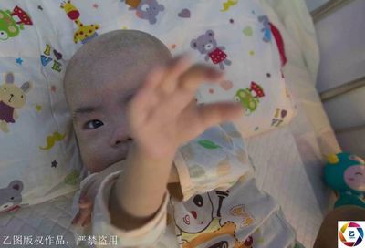 出生半个月的宝宝拉肚子怎么办