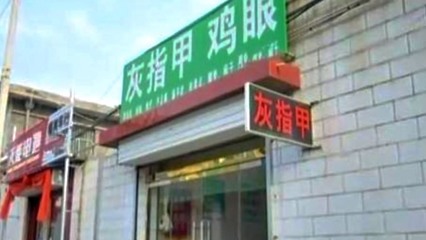 修脚店去鸡眼多少钱