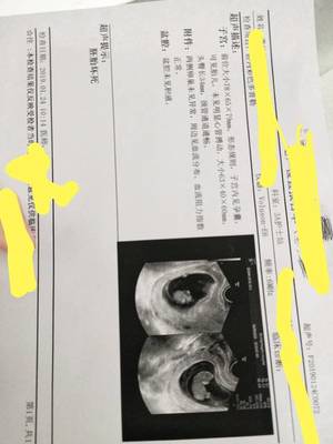 怀孕半个月肚子疼