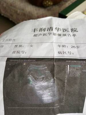 怀孕2个月最准看男女