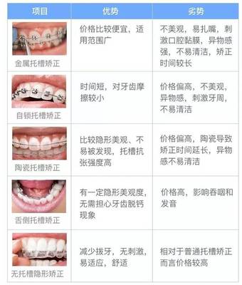 12矫正牙齿需要多少时间