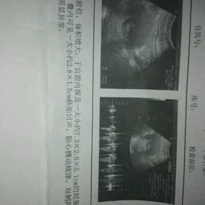 月经前三天会怀孕吗