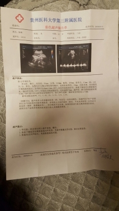 36周宫缩对胎儿的危害