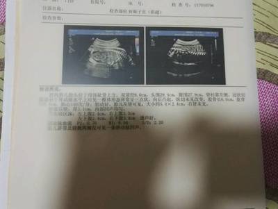 单肾宝宝