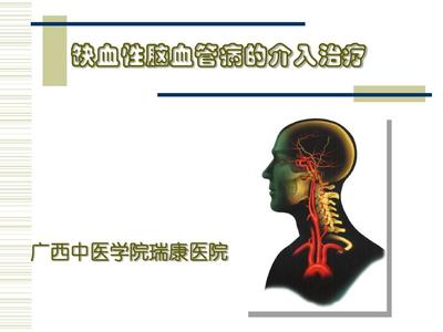 脑血管有问题怎么治疗
