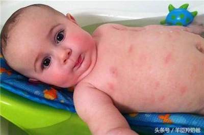 宝宝吃猕猴桃过敏症状