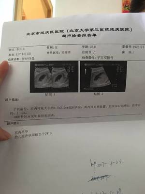 宫腔积血是怎么回事