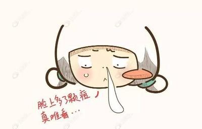 长痘痘痤疮不能吃什么东西
