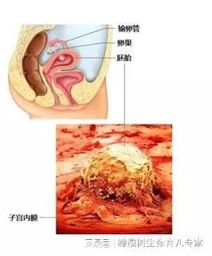 什么是生化怀孕