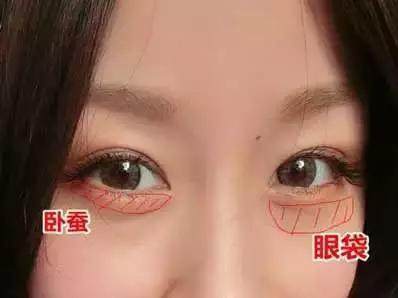 有眼袋的女人面相