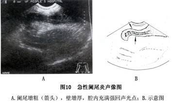 小孩肠系膜淋巴结肿大怎么治疗