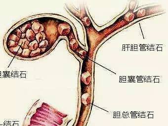 胆总管压力是多少