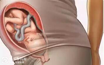 怀孕一个月会有肚子吗