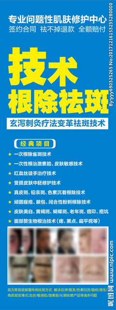 签约祛斑合同