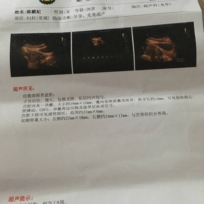 吃孕酮对胎儿有影响吗