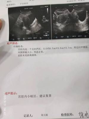 小腹坠痛是怀孕了吗