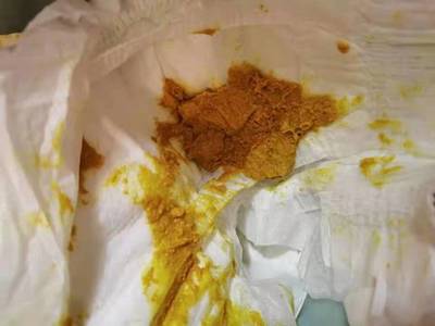 新生儿吃奶粉便秘拉不出来怎么办
