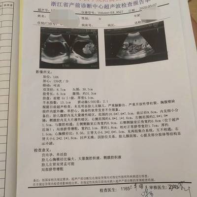 胎儿照片大全集32周